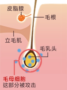 因为抗癌剂不只针对癌细胞，他也会攻击一般正常细胞。